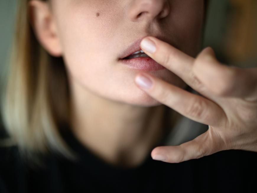 Frau pflegt Lippen mit Augencreme