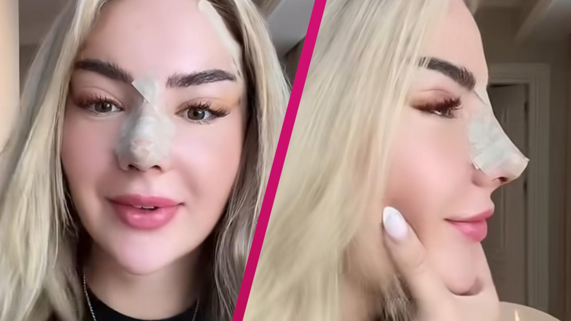 Emma-Fernlund-User-spotten-nach-Beauty-OP-Sieht-aus-wie-Kim-Virginias-Schwester-