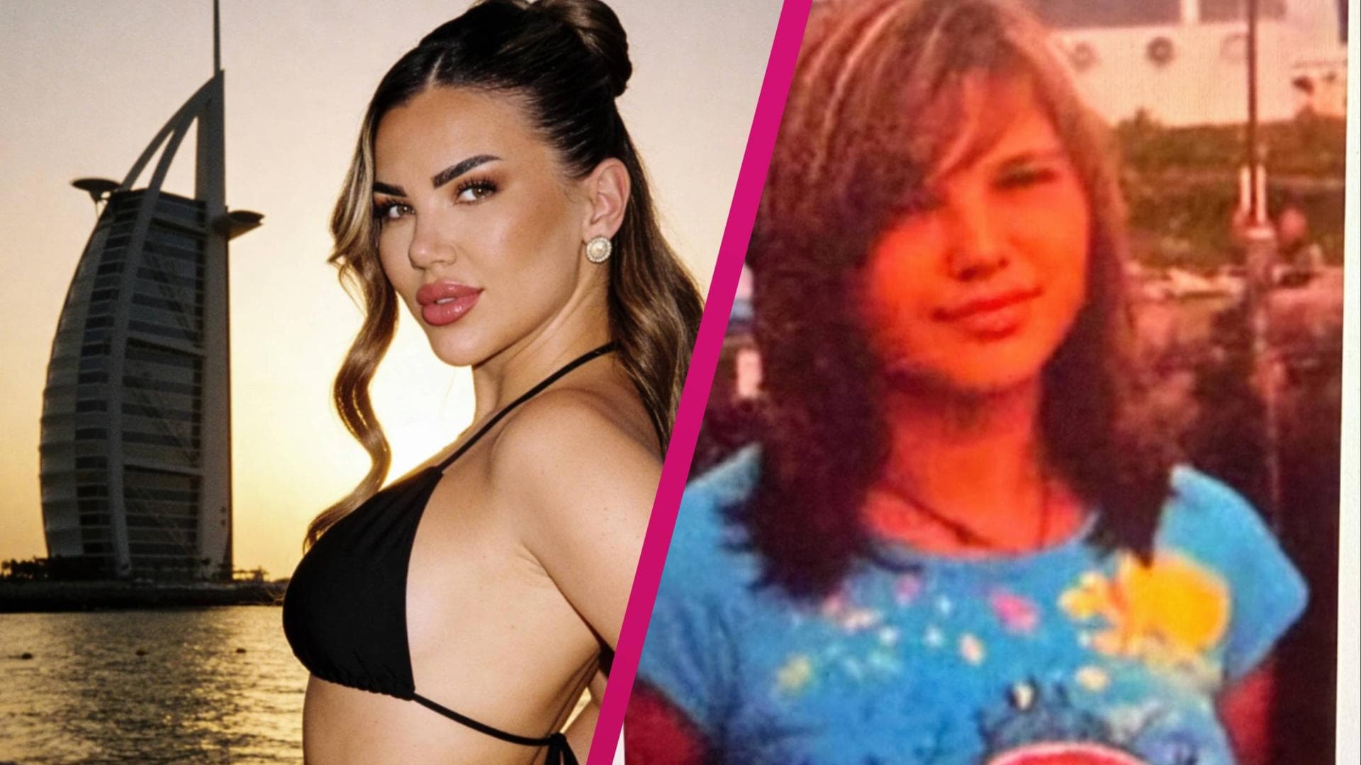 Kim-Virginia-Hartung-Heftige-Kritik-f-r-Jugenfoto-Da-hat-der-Doktor-gut-gearbeitet-