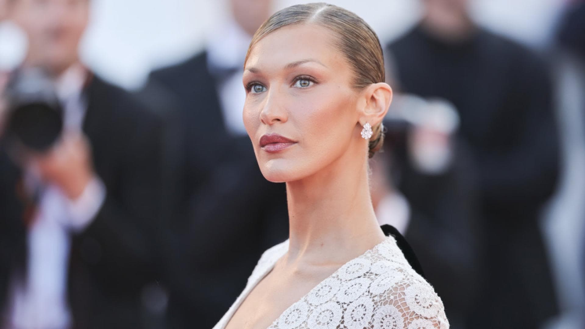 Bella-Hadid-So-krank-ist-sie-wirklich