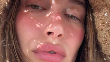 Hailey Bieber rötliche Haut und Schmollmund