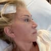 Carmen Geiss nach OP mit Pflaster