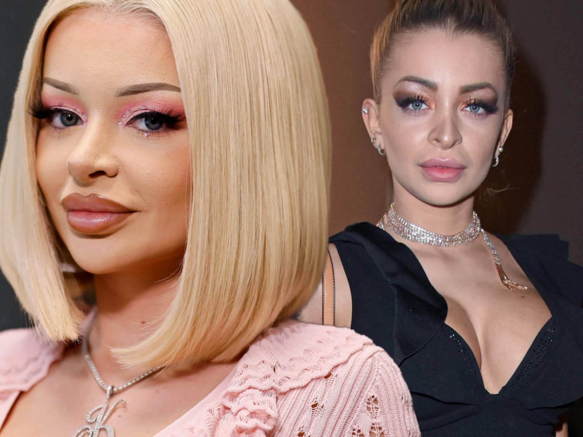 Katja Krasavice vor und nach ihrem Beauty-OPs