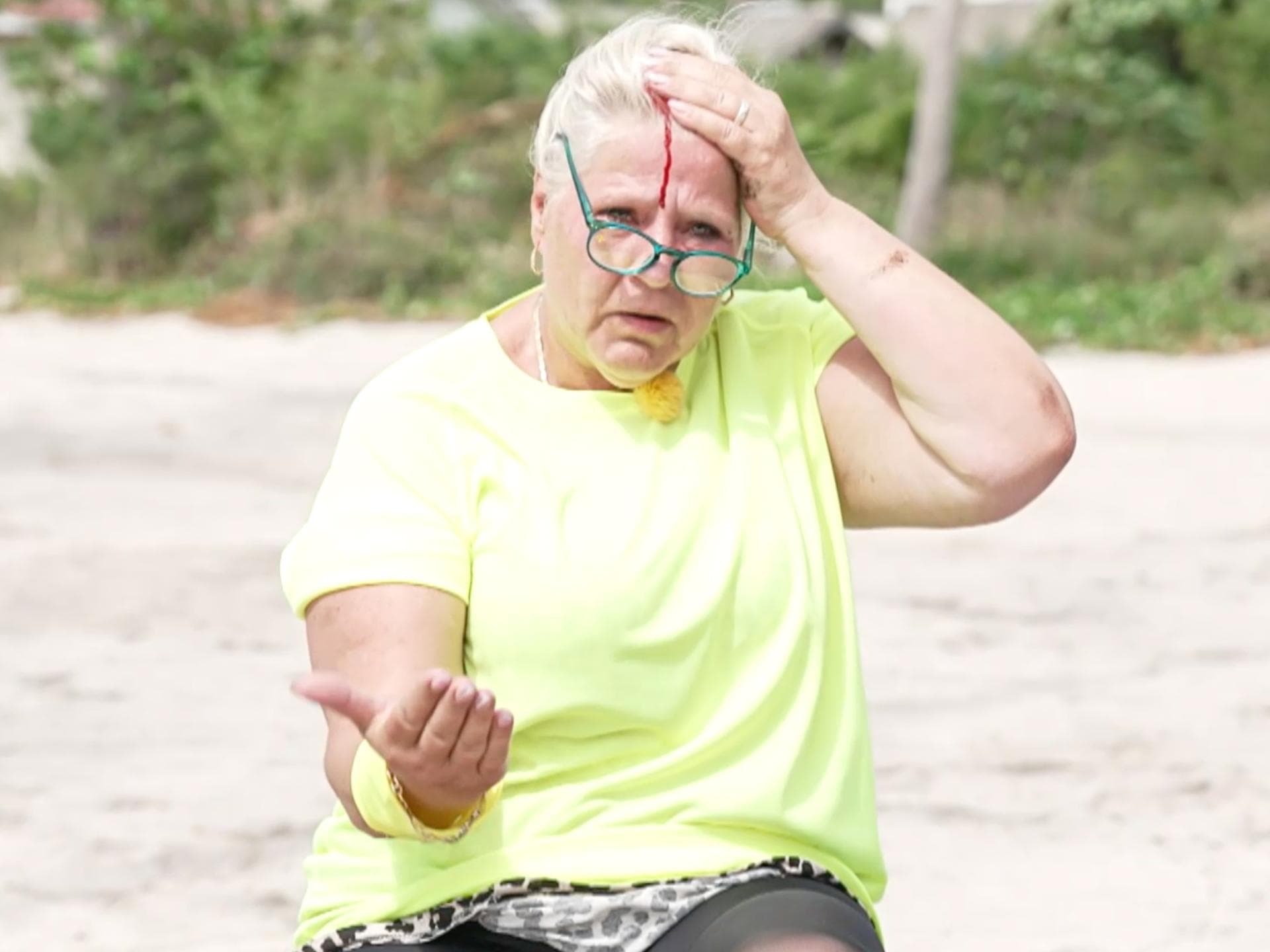 Silvia Wollny hat sich bei "Promis unter Palmen" verletzt und musste die Show vorzeitig verlassen