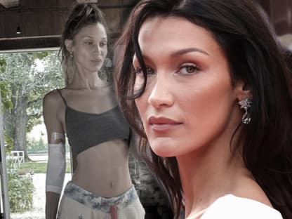 Bella Hadid zeigt sich mit verwundetem Arm