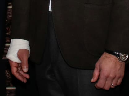 Prinz Carl Philips verletzte Hand in einem Gips.