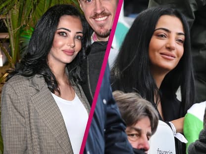 Dilara Kruse früher vor der Nasen-OP und heute