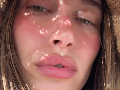 Hailey Bieber rötliche Haut und Schmollmund