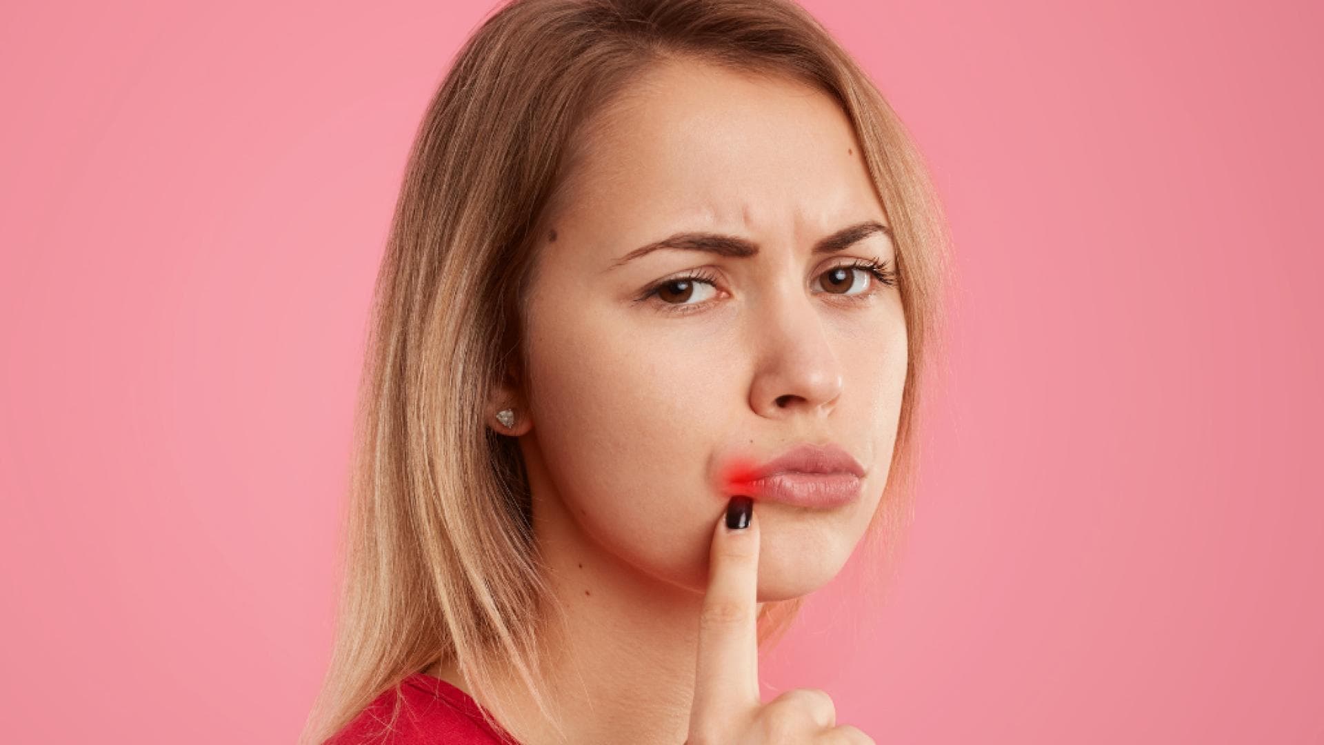 Herpes vorbeugen So entstehen Lippenbläschen gar nicht erst