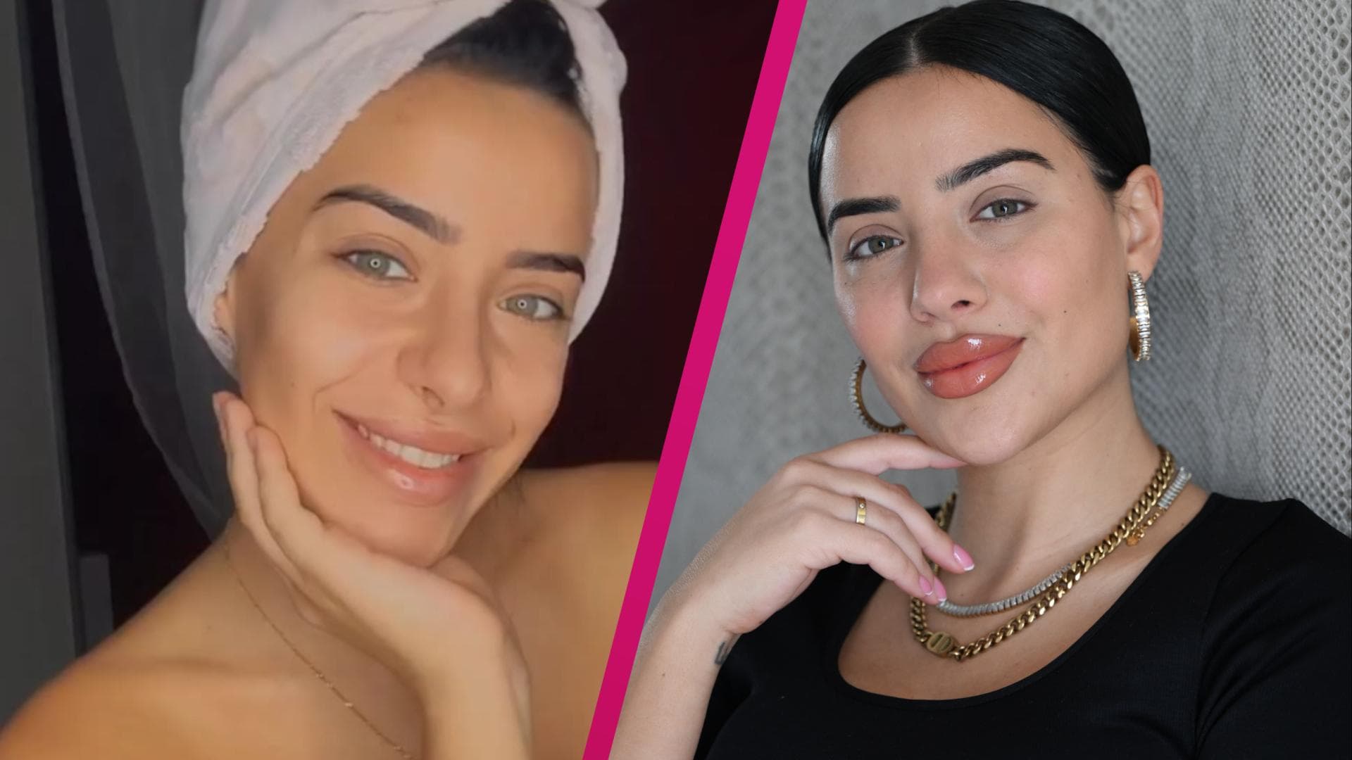 Leyla Lahouar Früher & heute So sah sie vor den BeautyOPs aus