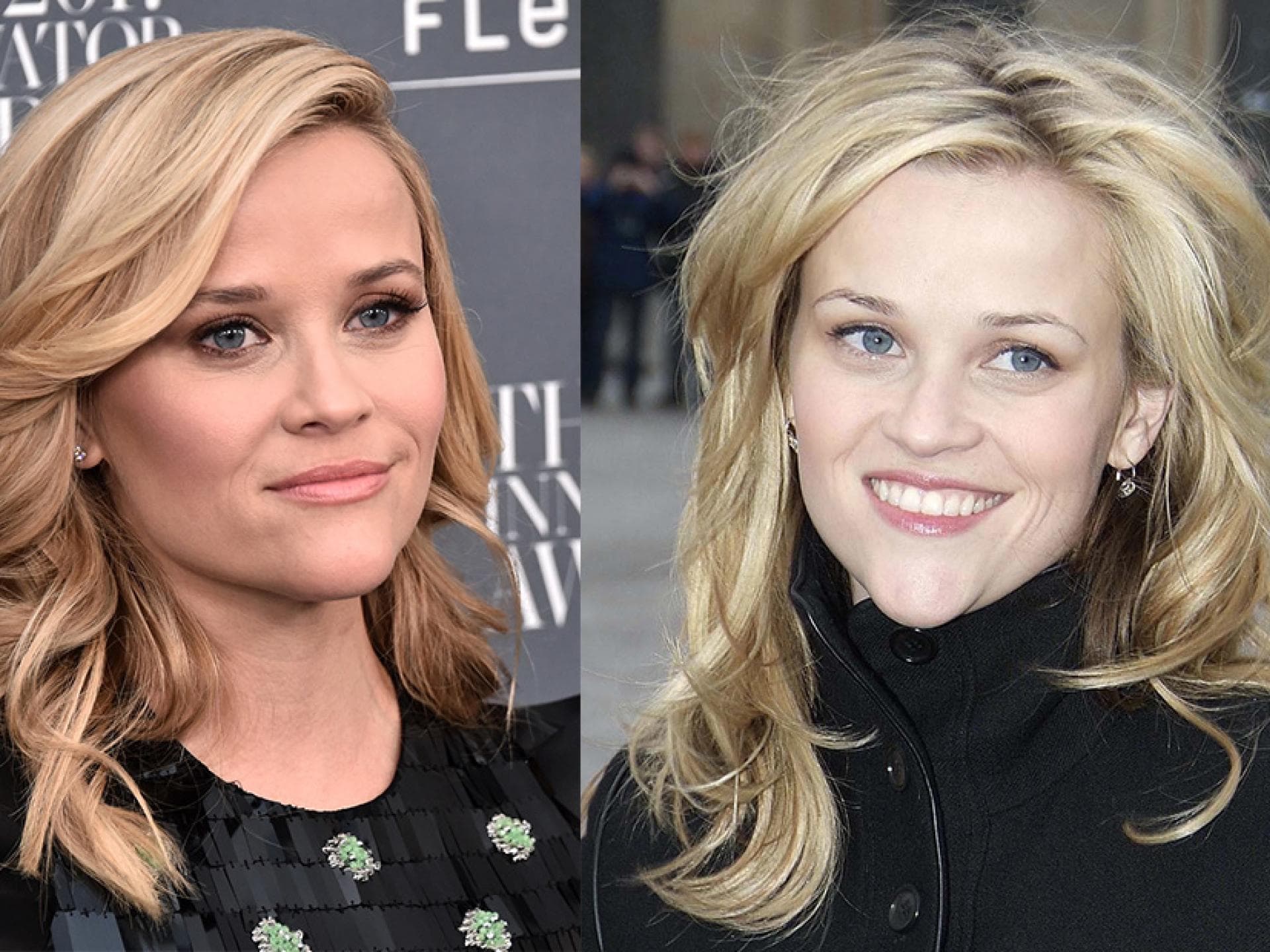 Ein neues Kinn: Hollywoods neuer Schönheitstrend