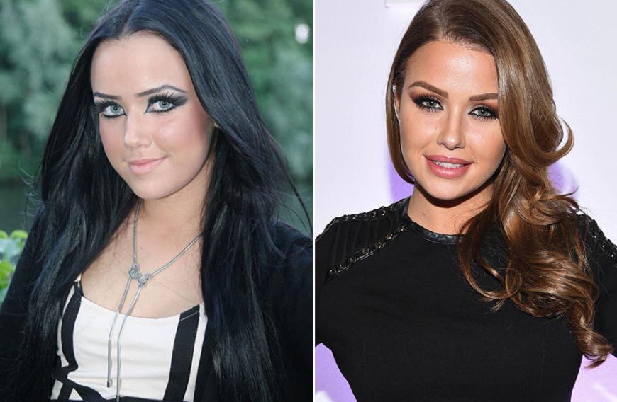 Die Krassesten Beauty Transformationen Der Stars