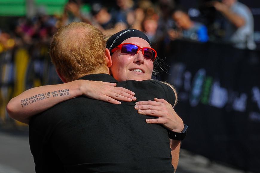 prinz harry haatransplantation fur 90