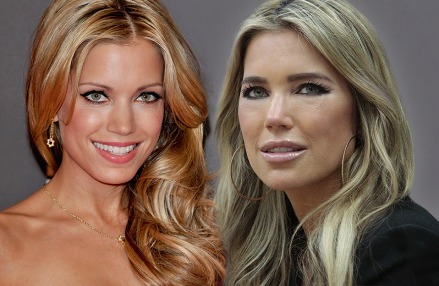 Die Krassesten Beauty Transformationen Der Stars