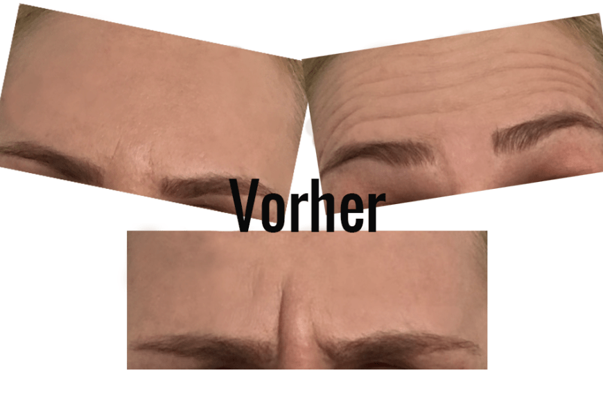 Vorher setzte sich schon das Make-up in den Falten ab, Schluss damit.