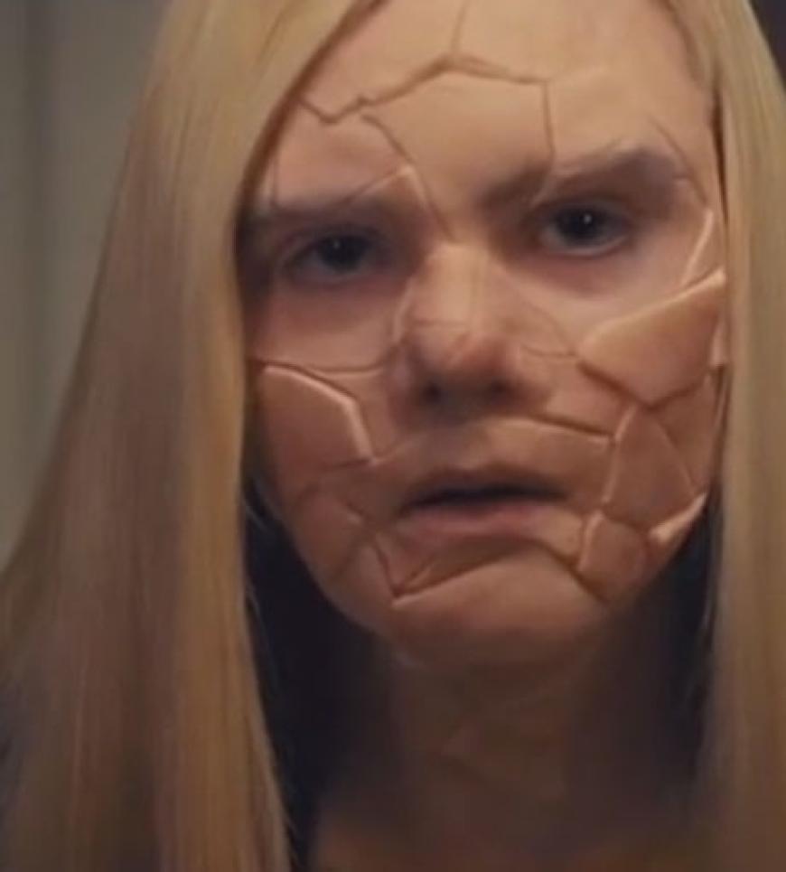 Bulimiker haben ein gestörtes Selbstbild: Elle Fanning in