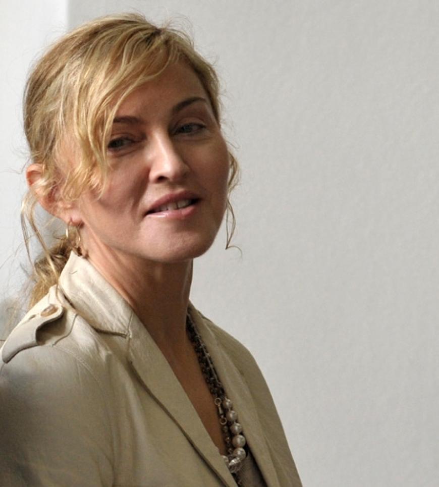 Die wohl bekannteste Zahnlücke des Entertainment-Geschäfts hat Pop-Diva Madonna.