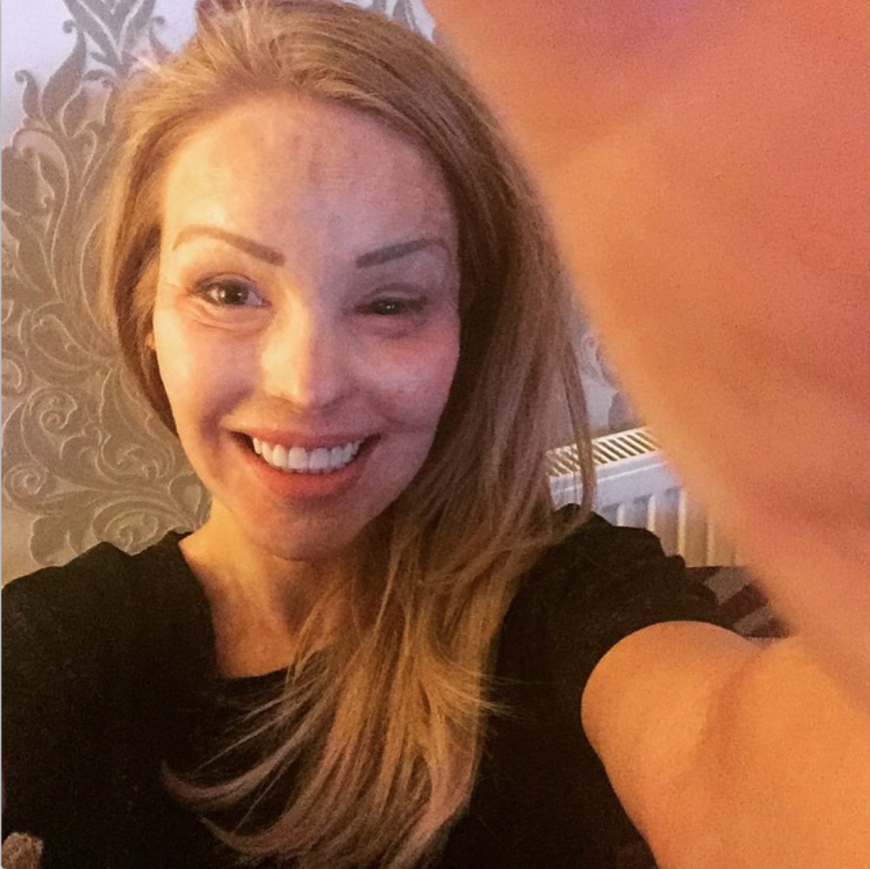Auch ungeschminkt zeigt sich Katie ohne Scham.