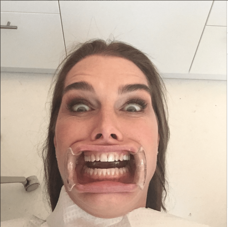 Cheese! US-Schauspielerin Brooke Shields hat Biss und beeindruckt ihre Follower mit Plastikschiene und XXL-Gebiss beim Zahnarzt.