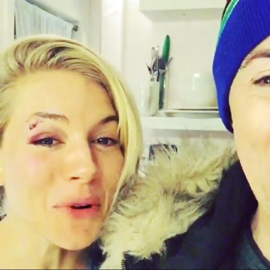 Kann wieder lachen: Sienna zeigte ihr Veilchen auf einem Instagram-Video mit ihrem Schauspiel-Kollegen Alan Cumming.