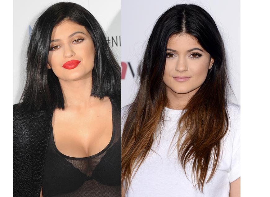Kylie Jenner mit Schmollmund (l.) und ohne geschminkte XL-Lippen (r.)