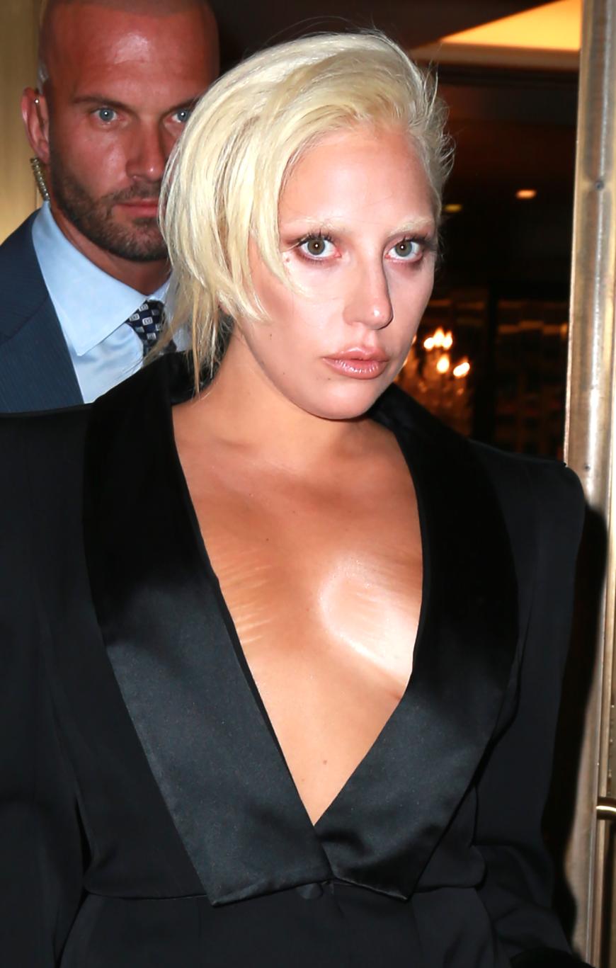 ...Lady Gaga ein Lied singen. Die ständigen Gewichtsschwankungen haben auf ihren Brüsten Spuren hinterlassen.