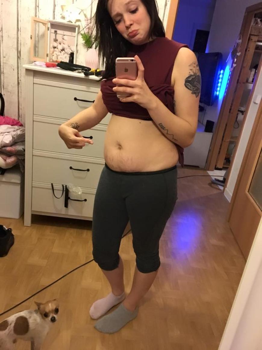 Anne Wünsche ist nach der Geburt ihrer zweiten Tochter unzufrieden mit ihrem Körper und will abnehmen.