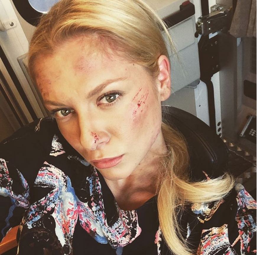 Auweia! Was ist denn mit Valentina Pahde passiert? Für ihren dramatischen Sturz in einen Aufzugschacht, hat die „Sunny