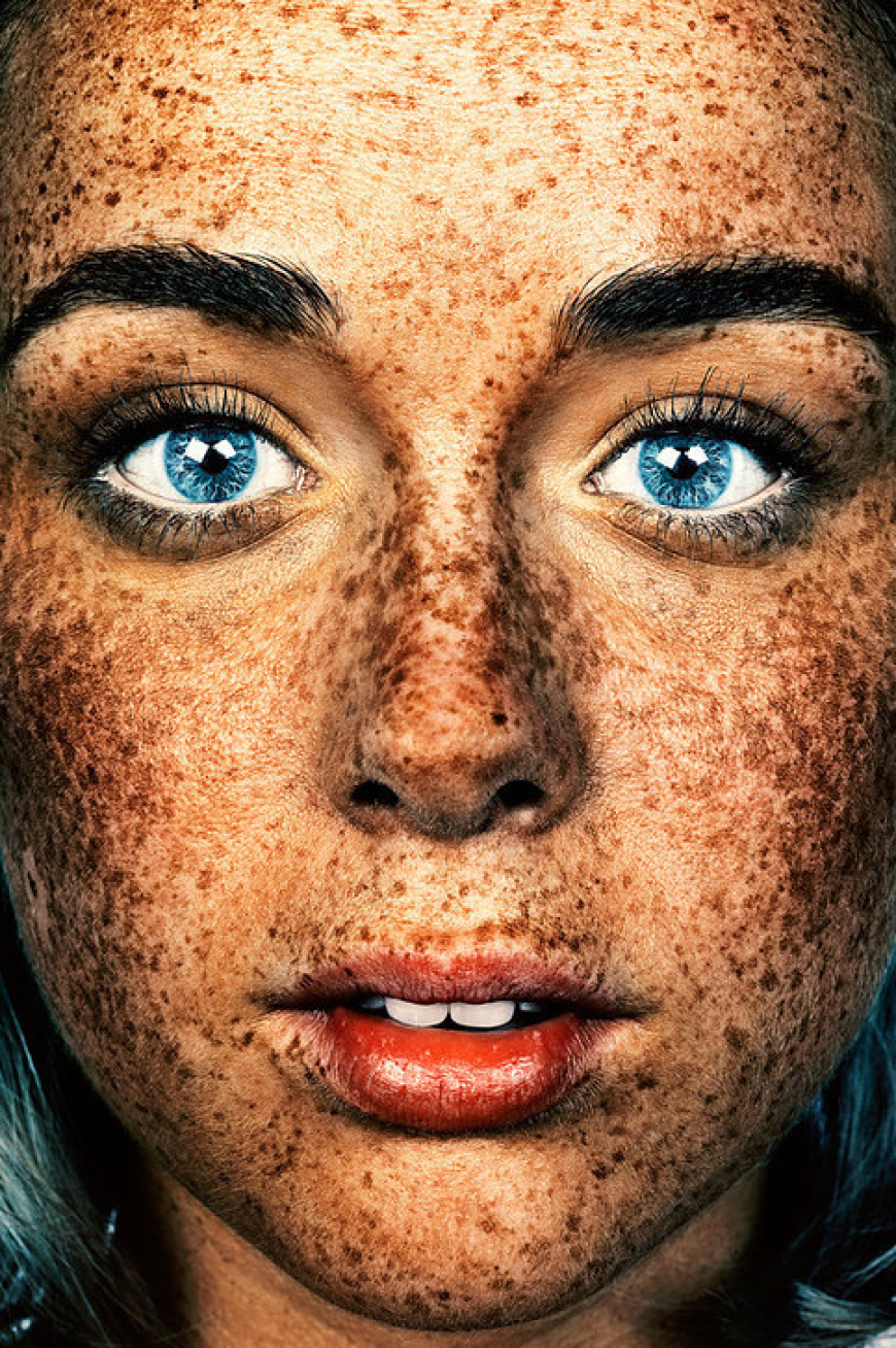 Brock Elbank - #Freckles