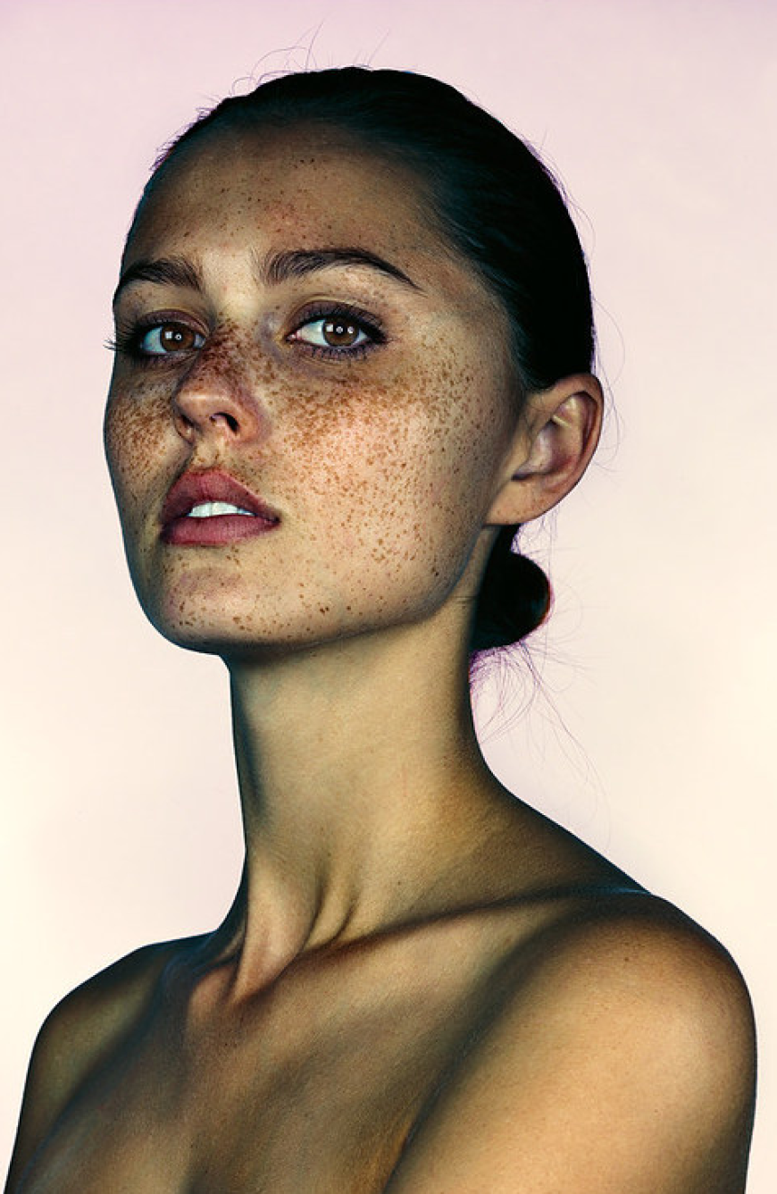 Brock Elbank - #Freckles