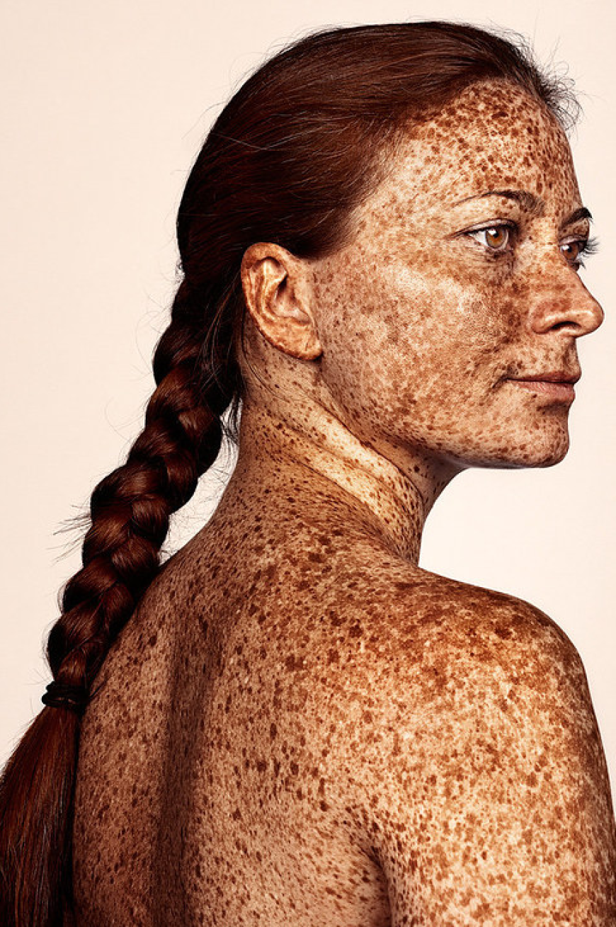 Brock Elbank - #Freckles