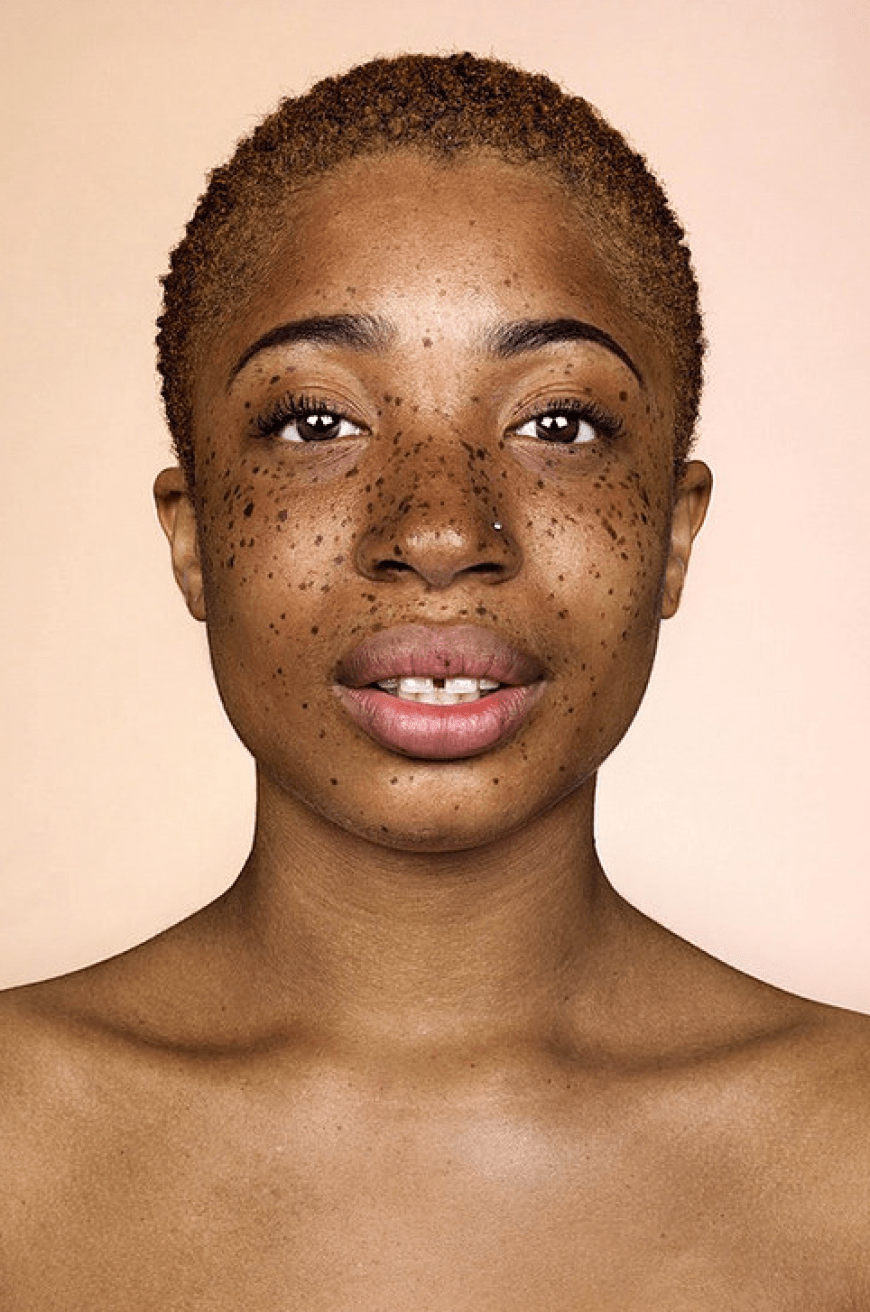 Brock Elbank - #Freckles