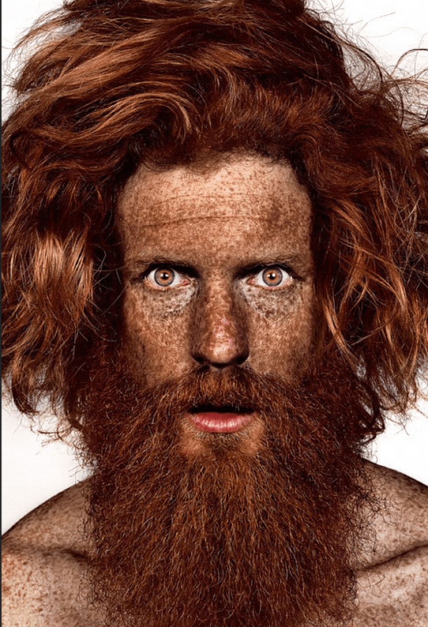 Brock Elbank - #Freckles