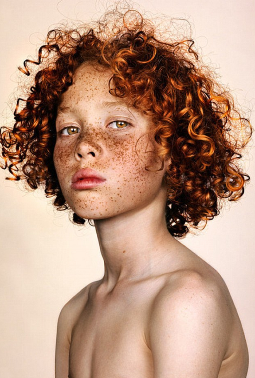 Brock Elbank - #Freckles