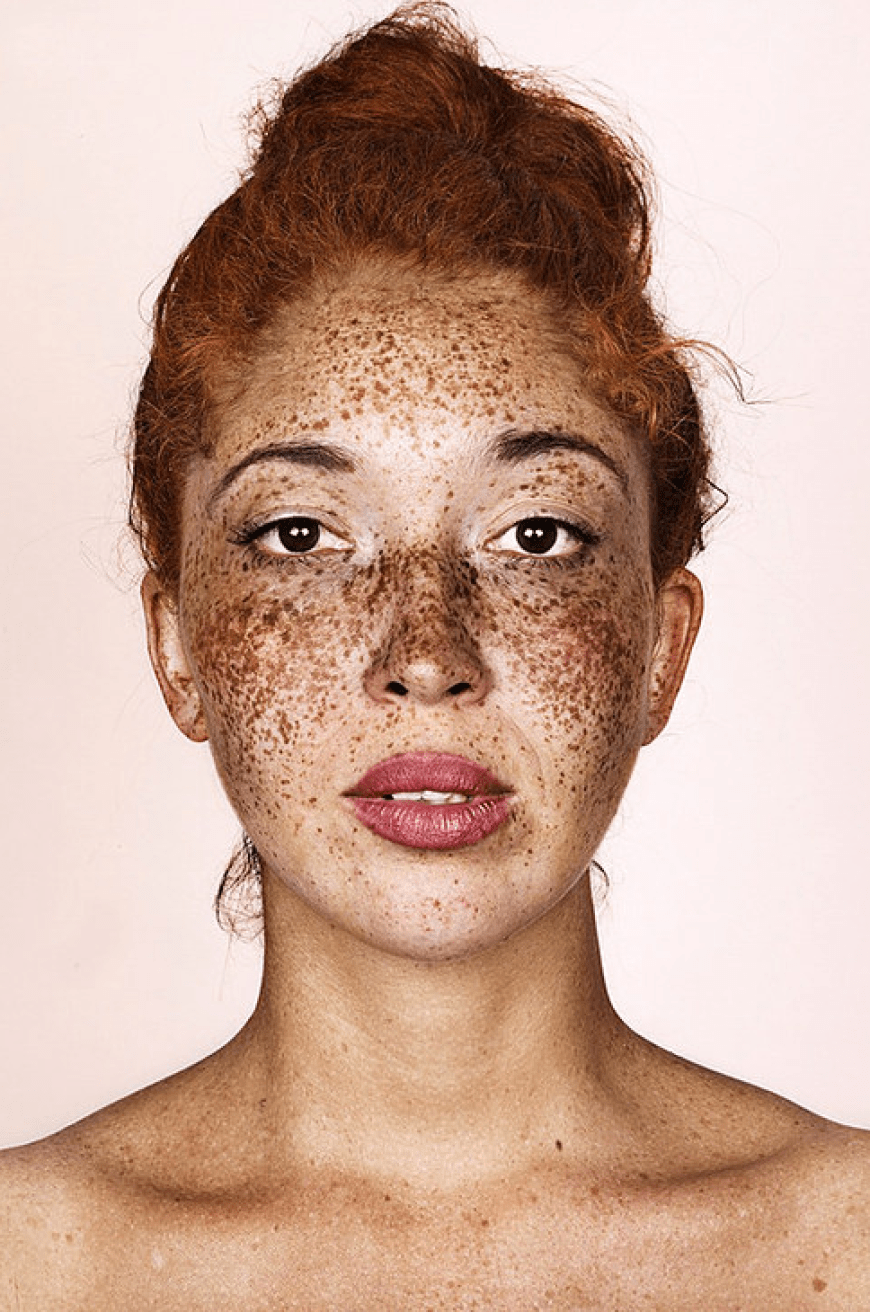Brock Elbank - #Freckles