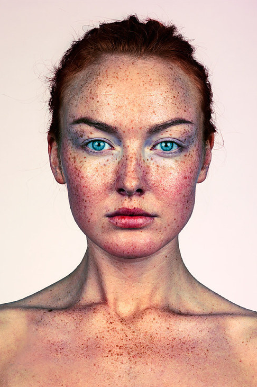 Brock Elbank - #Freckles