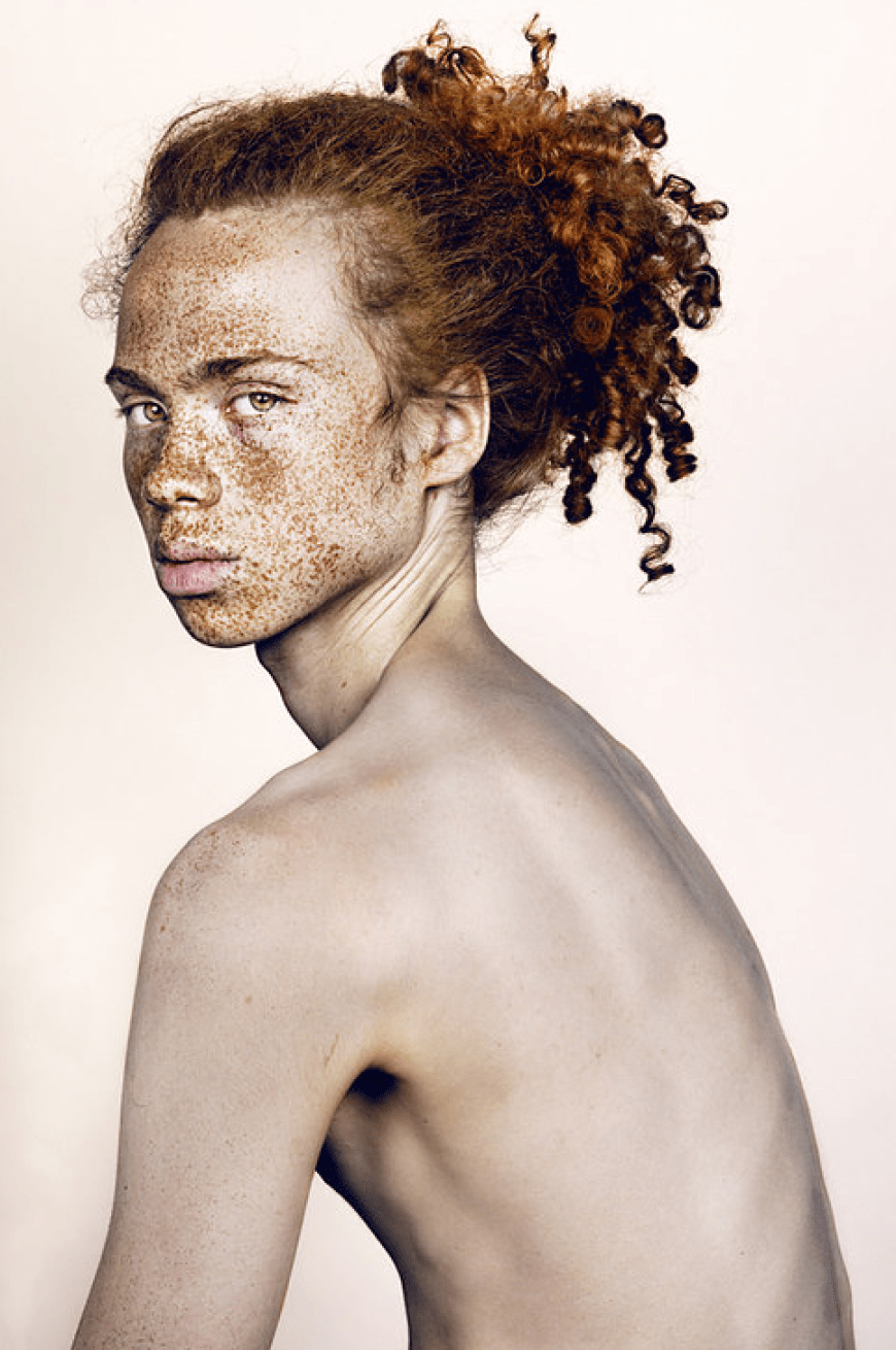 Brock Elbank - #Freckles