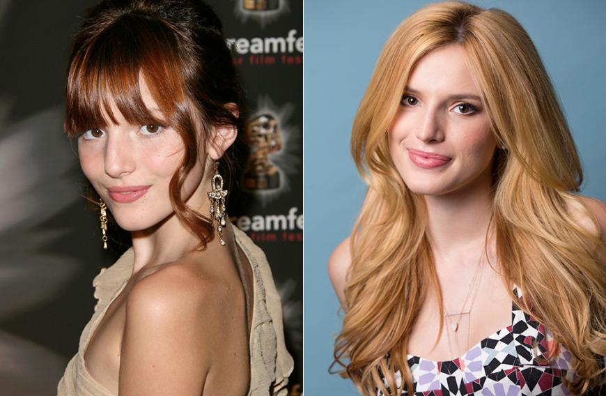 Bella Thorne, 18: Die Nase ist schmaler, die Oberlippe voller: Der US-Disney-Star soll seine Nasen-Verkleinerung bereits mit 16 Jahren vorgenommen haben. „Viele Mädels spüren den Druck, perfekt aussehen zu müssen“, versucht sich die Schauspielerin zu rechtfertigen.
