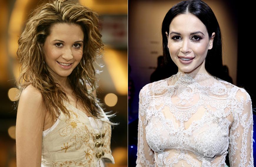 Mandy Capristo, 25: „Im Vergleich zu dem Vorher-Foto wirkt Mandys Mimik komplett verändert“, urteilt Prof. Dr. Mang. Er vermutet Botox. Davon will Mandy allerdings nichts wissen. Hauptsache, On-again-Sportsfreund Mesut Özil gefällt ihr neuer Frozen-Look ...