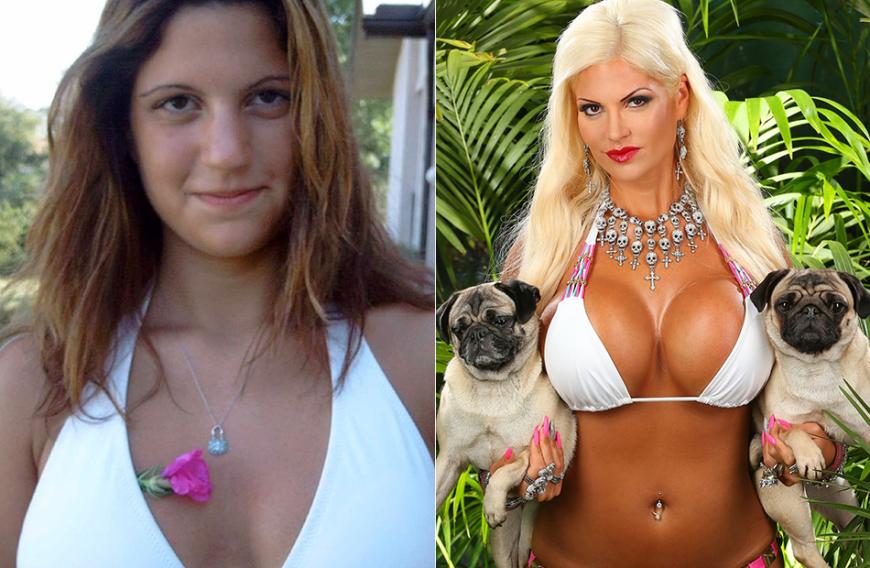 Sophia Wollersheim, 28, hat mit der 15-jährigen Sophia (links) heute keine Ähnlichkeit mehr. „Ich möchte dem Hollywood-Bild entsprechen: schlankes Gesicht, betonte Wangenknochen. Ich bin süchtig nach Beauty-Spritzen“, gibt die Dschungelcamperin zu. Dazu gesellen sich etliche Brust-OPs. Auch Ehemann Bert macht sich Sorgen.