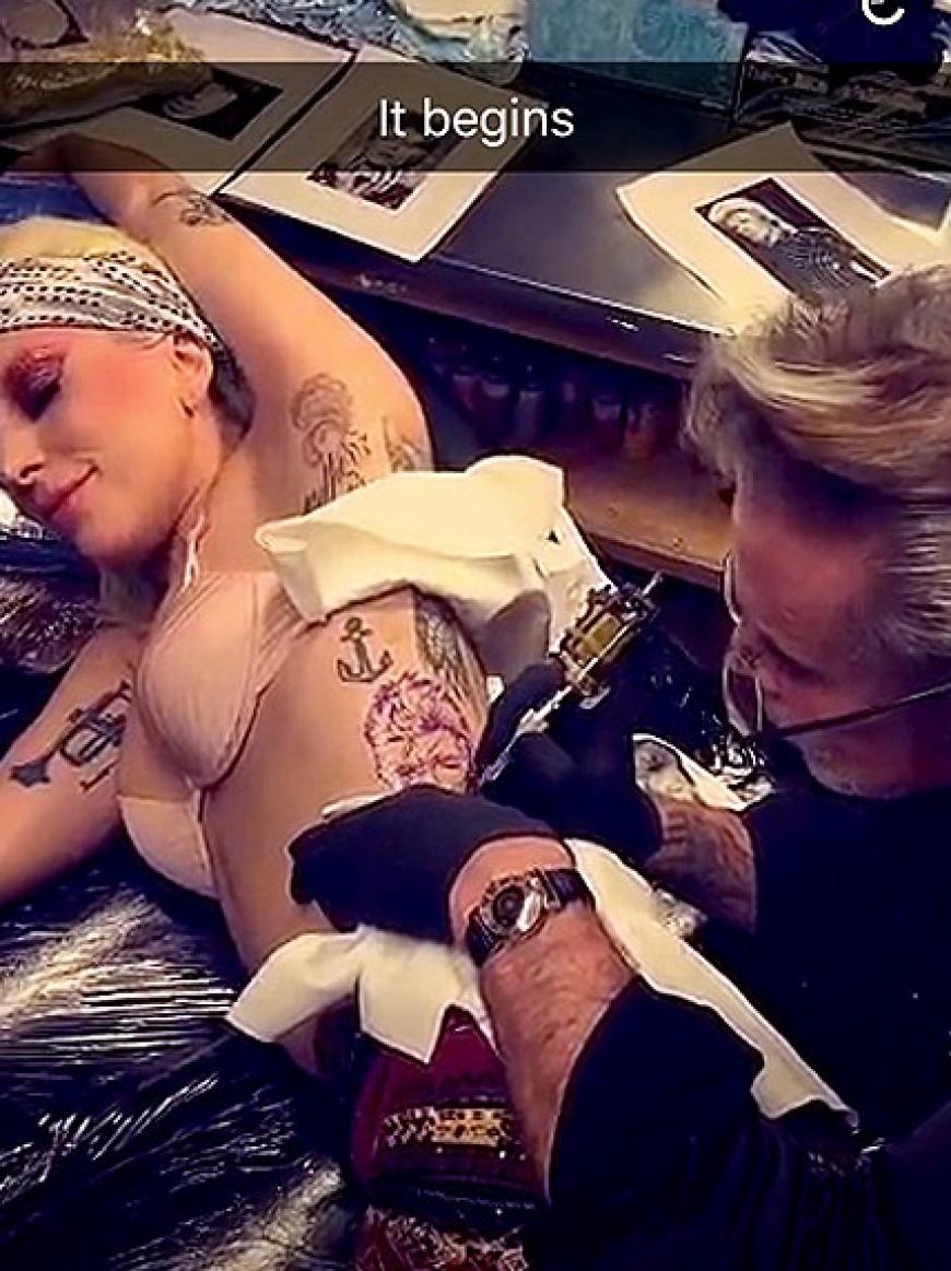 Via Snapchat lässt Lady Gaga ihre Fans an der Prozedur teilhaben.