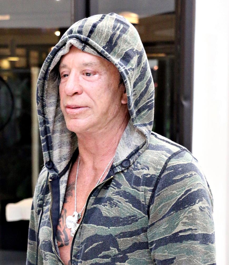 Autsch! Mickey Rourke hat scheinbar schon wieder an seinen Augenlidern rumschneidern lassen.