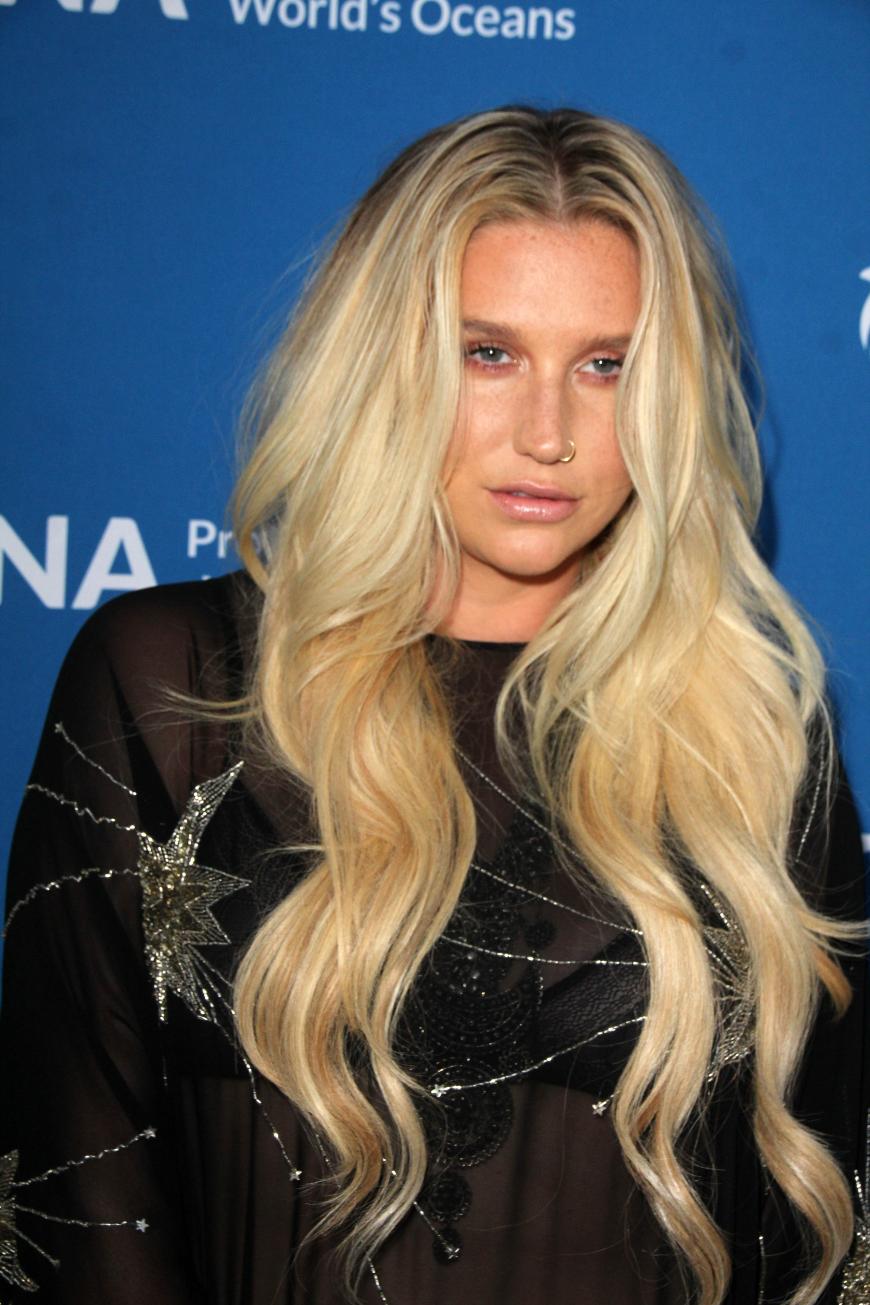 Nach der Niederlage im Missbrauchsprozess brach Kesha nun endlich ihr Schweigen.