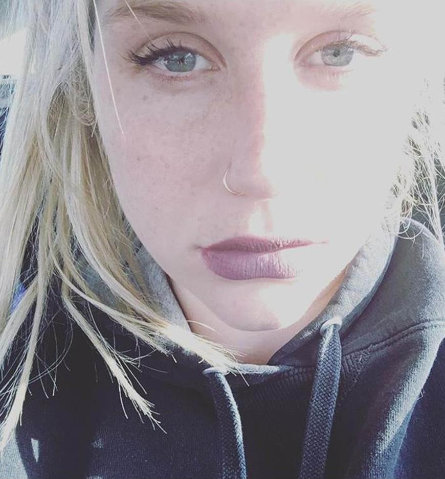 Ernste Miene und traurige, geschwollene Augen: Mit diesem Selfie und einem rührenden Statement meldete sich Kesha bei ihren Fans.