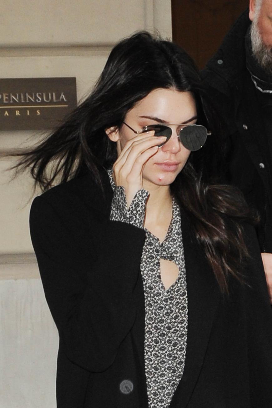 Kendall Jenner zeigt dabei ungeniert ihren Pickel am Kinn.
