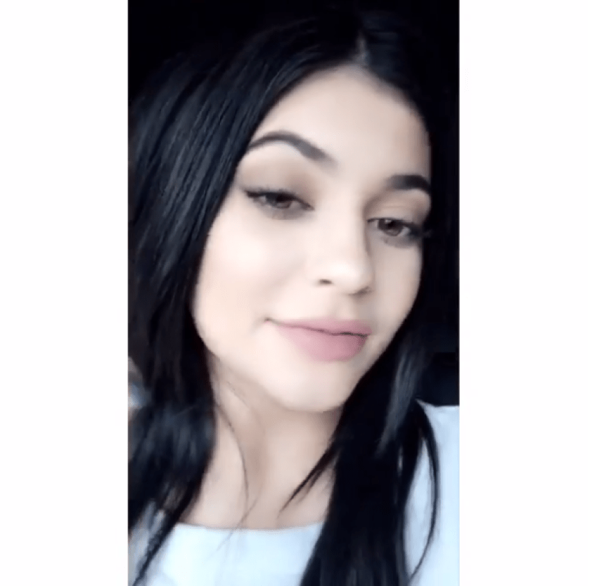 Kylie Jenner versteht die Diskussion um ihre Lippen nicht, wie sie auf Snapchat verrät.