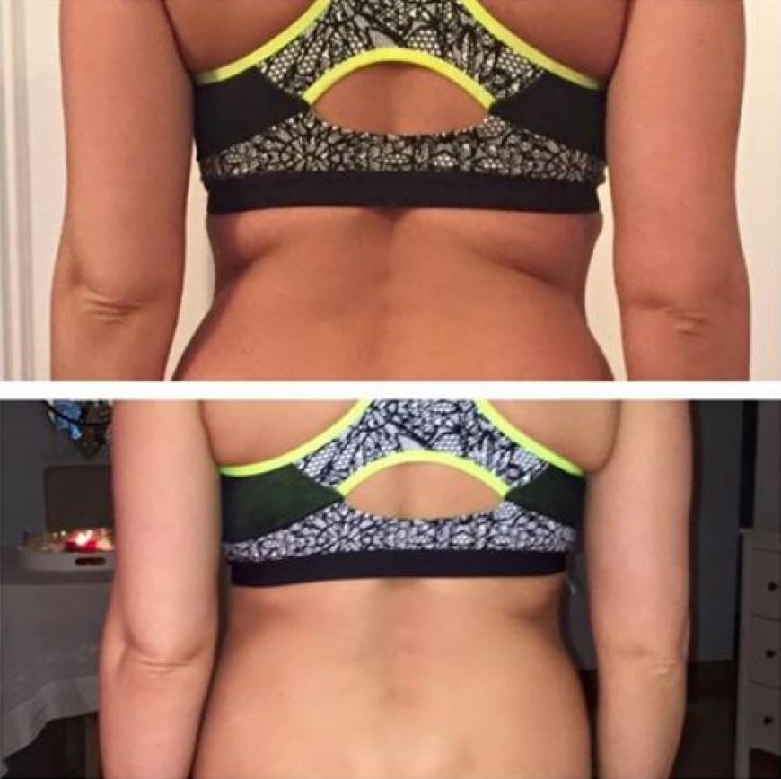 Vorher-Nachher-Vergleich: Links wog Daniela Katzenberger noch knapp 68 Kilo, rechts fünf Kilo weniger.