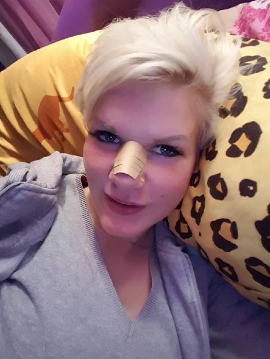 Melanie Müller hat sich die Nase machen und Fett absaugen lassen.