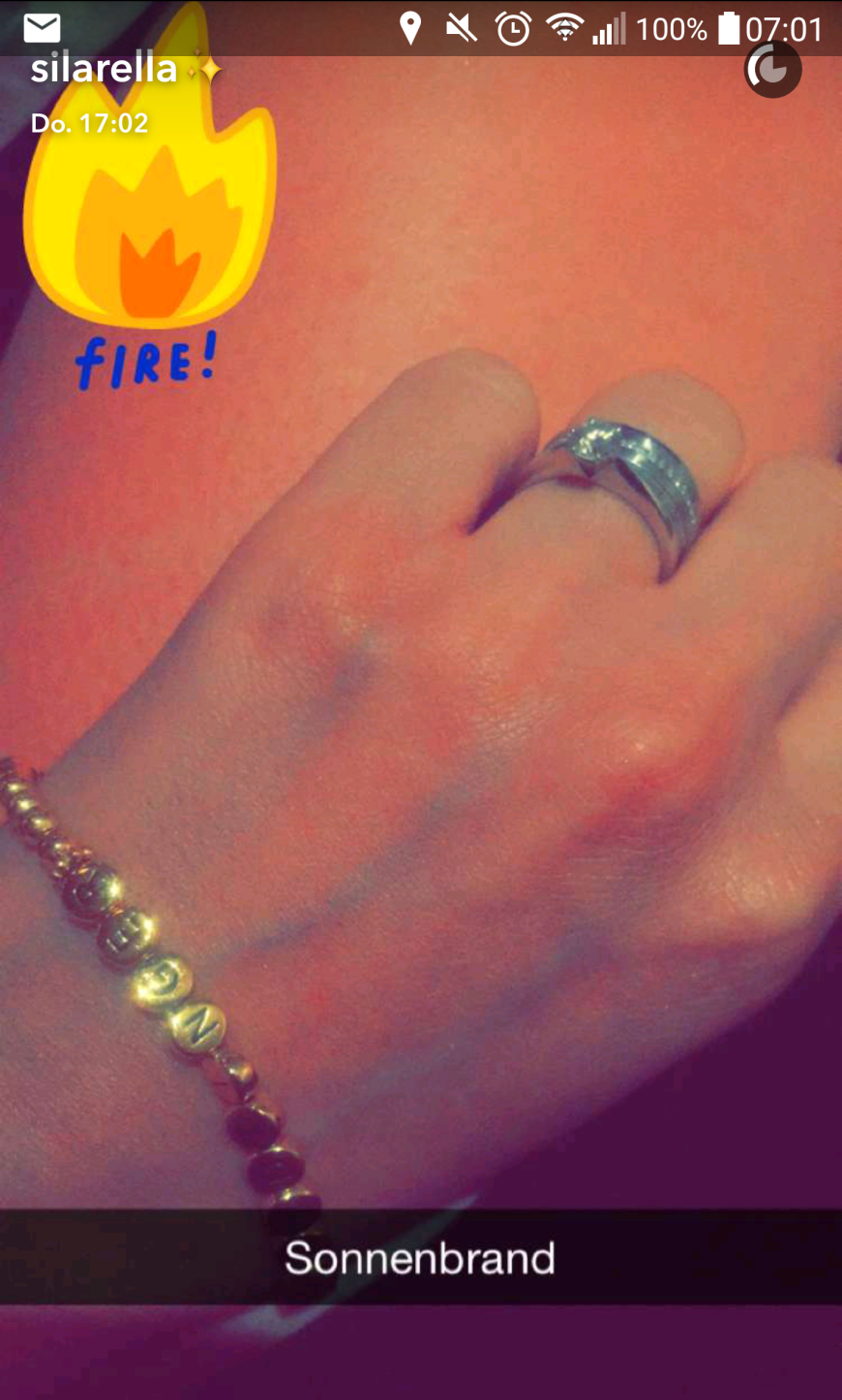 Auf Snapchat zeigt Sila Sahin ihren Sonnenbrand - und ihren Ehering!