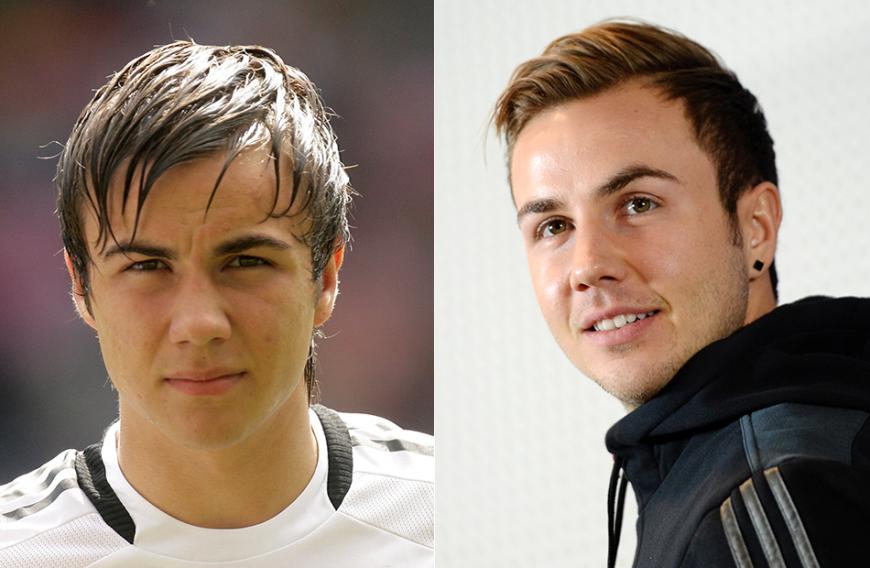 Mr. Schleimhaar lässt grüßen: Mario Götze früher und heute